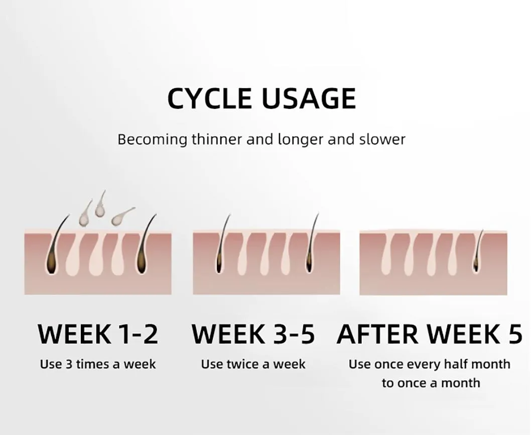 IPL Hair Removal Machine 4