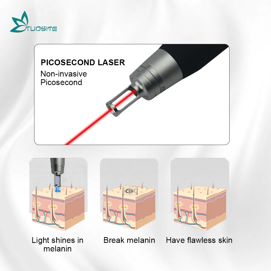 Professional Picosecond Laser Tattoo Removal Carbon Peeling Machine
