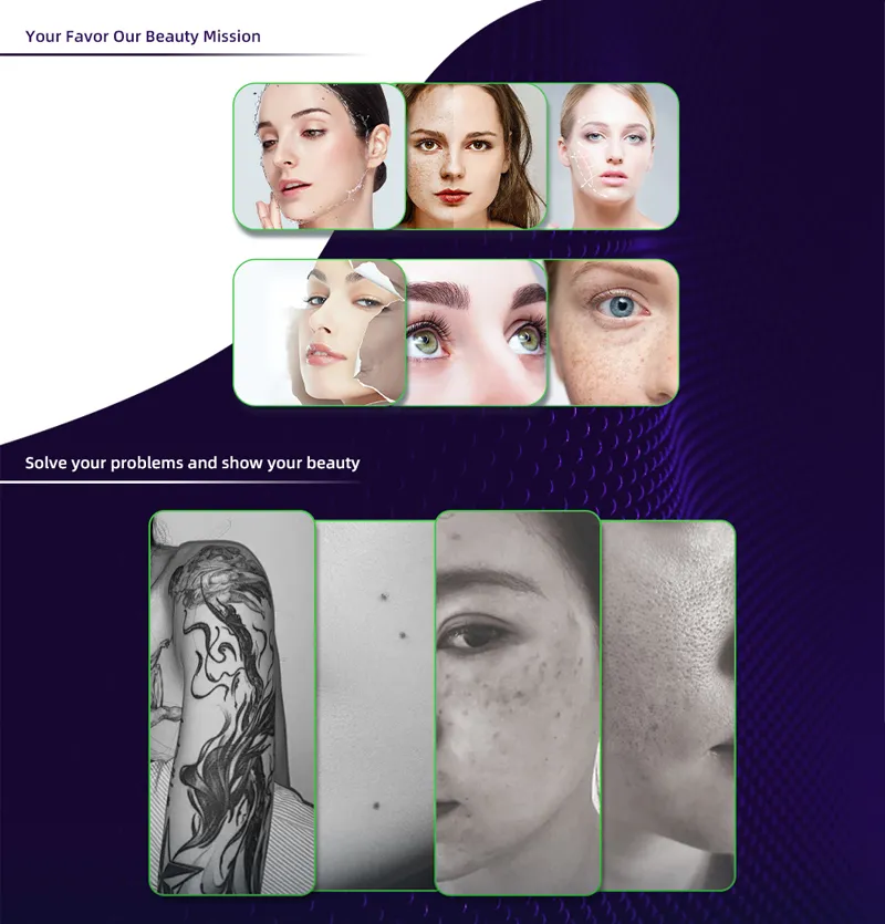 7 Joint Articular Arm