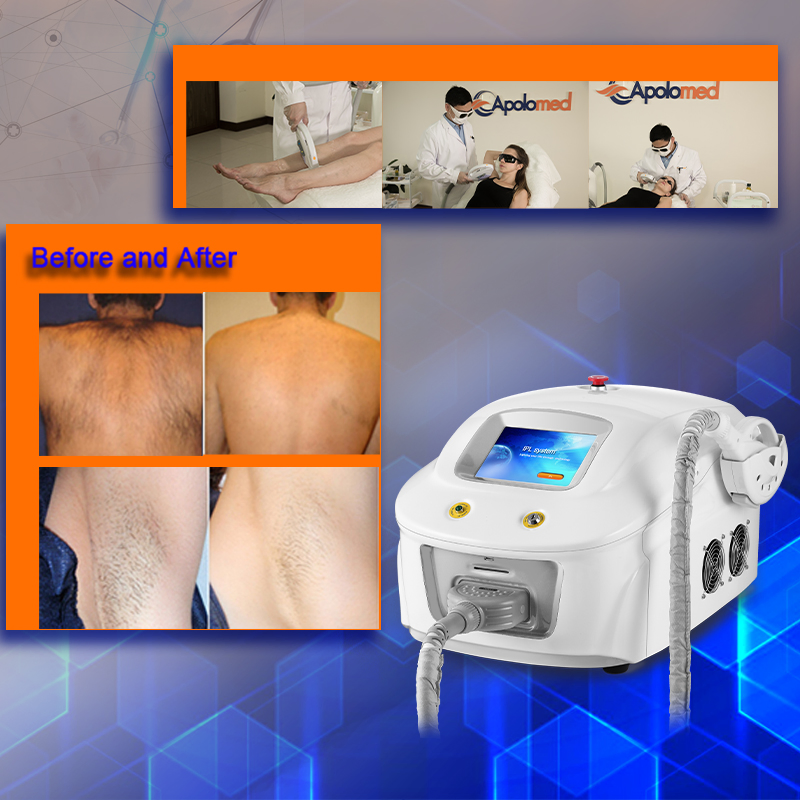 Skin Rejuvenation Hair Removal Beauty Machine (IPL+E-light) (HS-310)