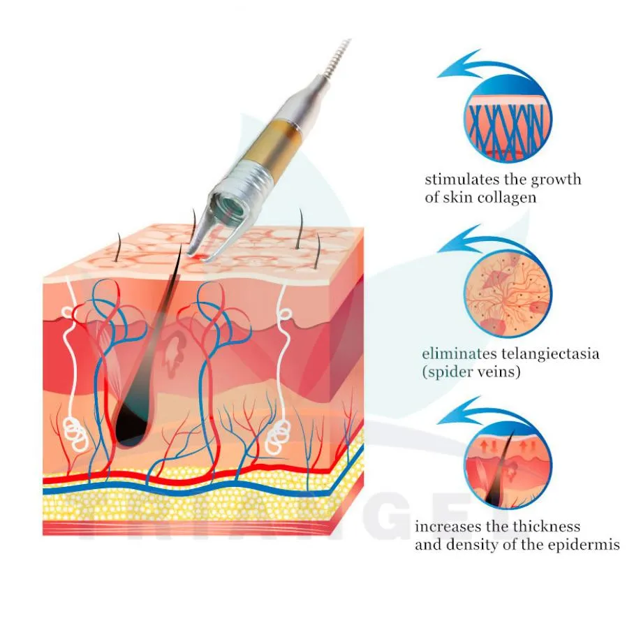 Portable Device Design