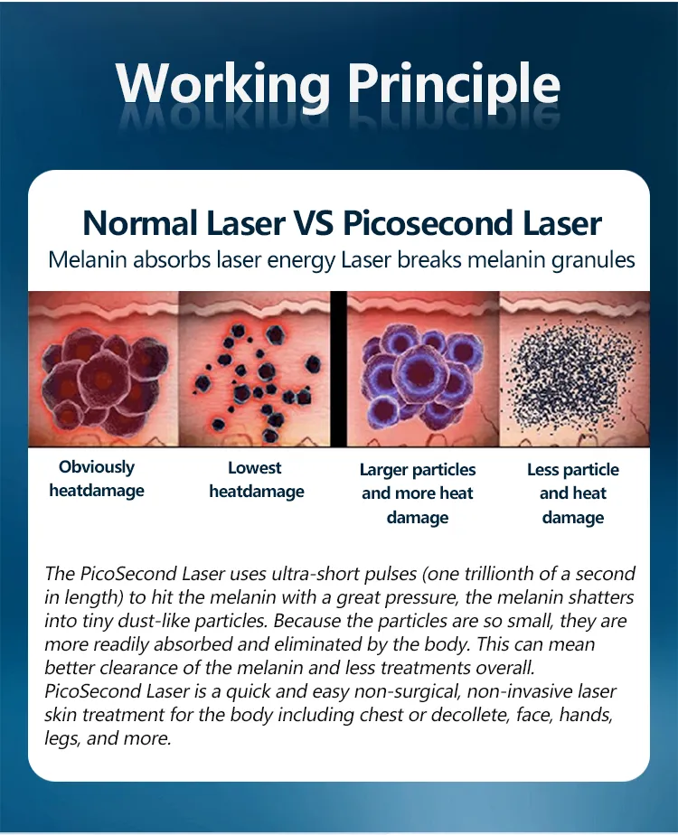 Working Principle Image 1