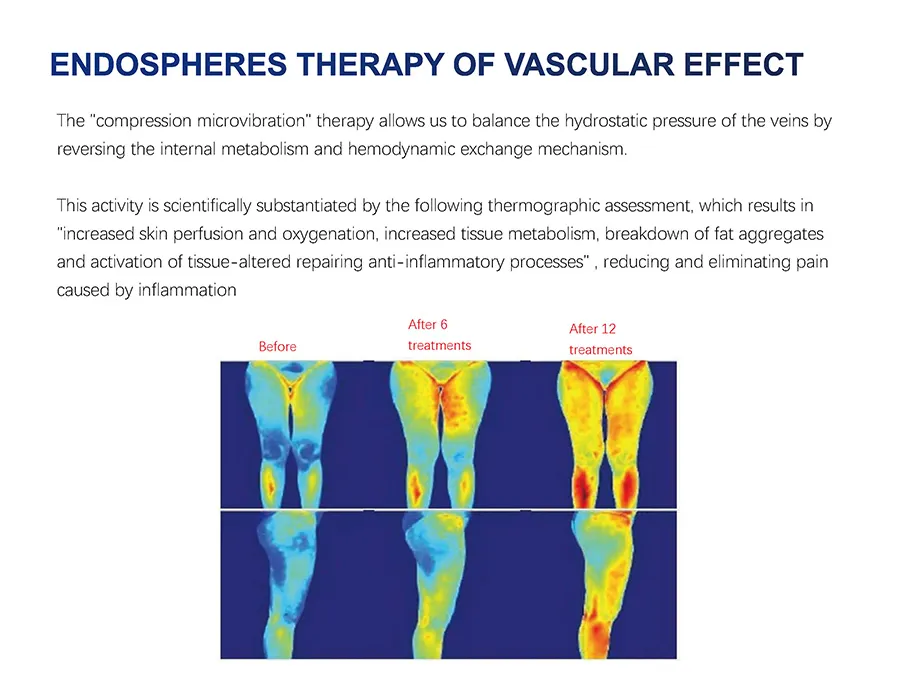 Endosphere Therapy Machine 5