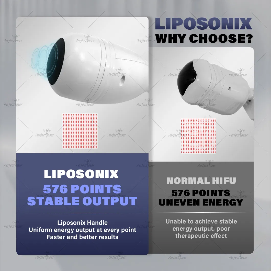 Liposonix 2