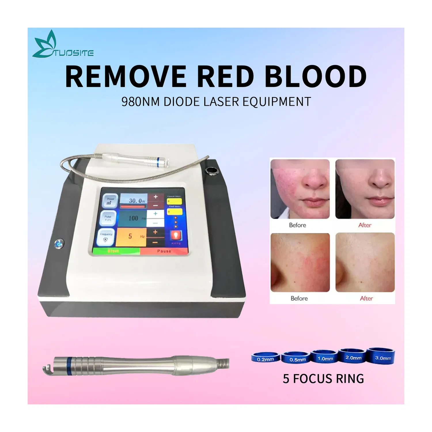 Lifetime Warranty 980nm Diode Laser Vascular Spider Vein Beauty Machine