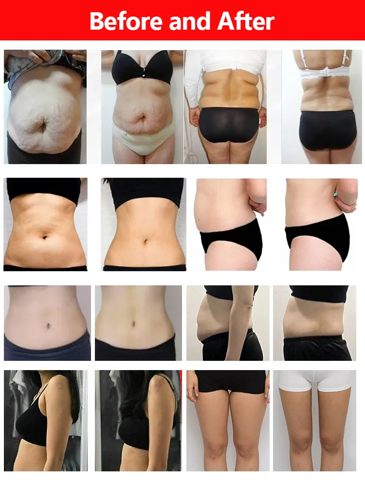 Before and After Results