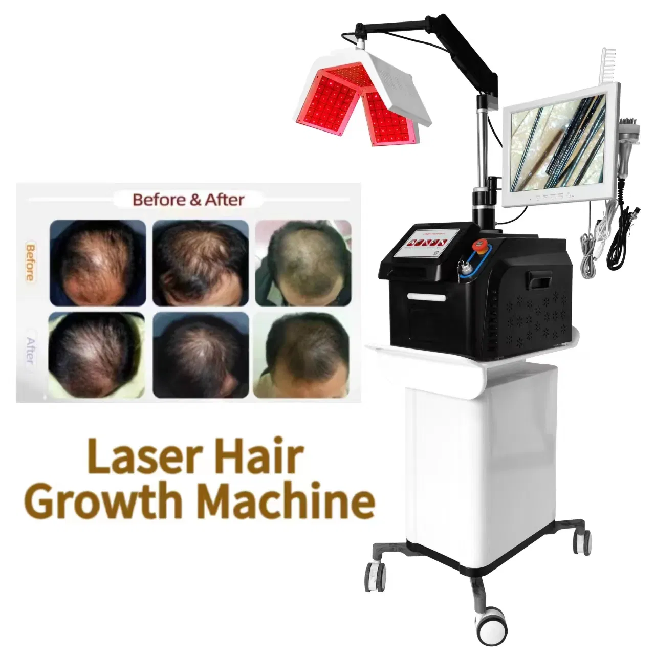Hair Loss Treatments for Hair Growth, Men and Women Laser Hair Growth Machine Hair Follicle Detection