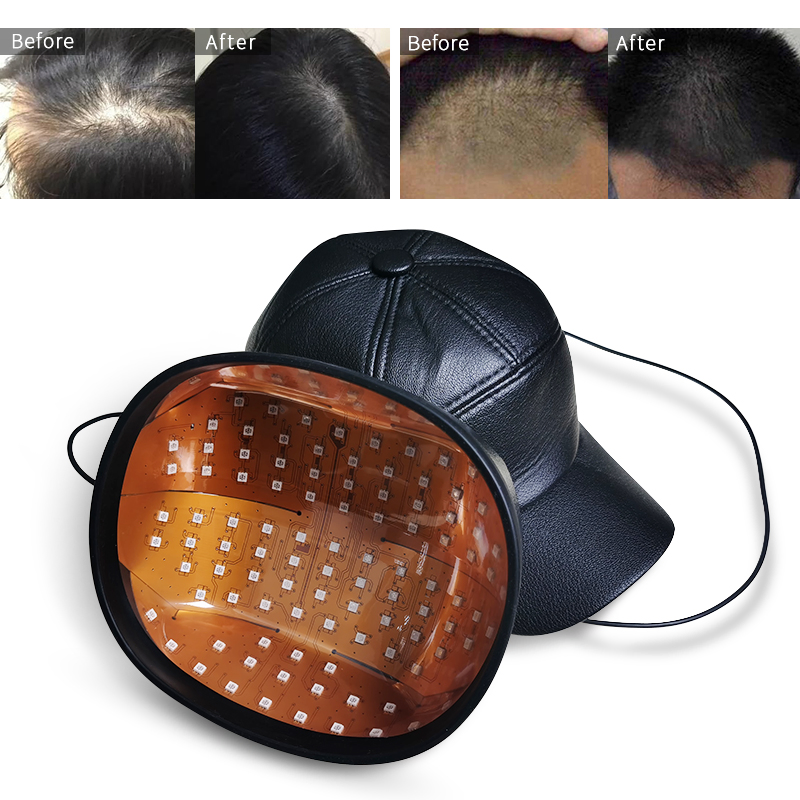 New Hair Regrowth Laser Diodes Helmet Hair Treatment Cap