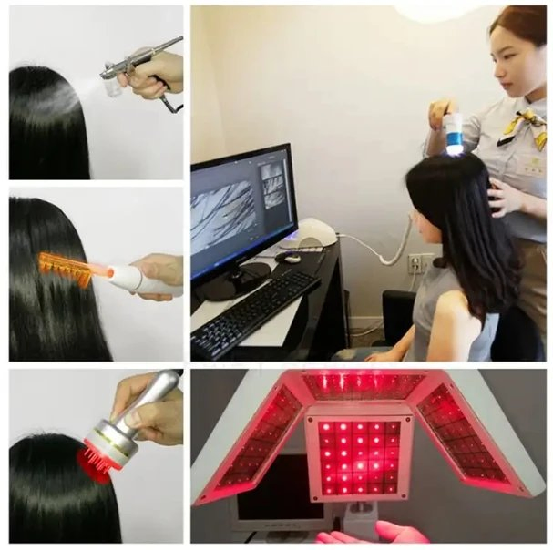 Hair Loss Treatments for Hair Growth, Men and Women Laser Hair Growth Machine Hair Follicle Detection