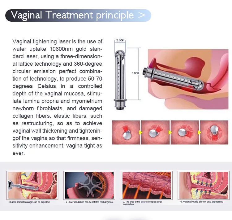 Vaginal Rejuvenation Process