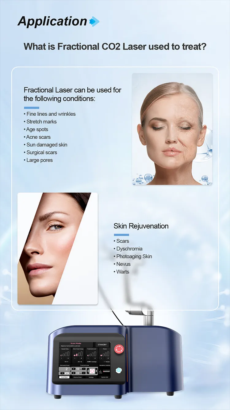 Fractional Laser Application