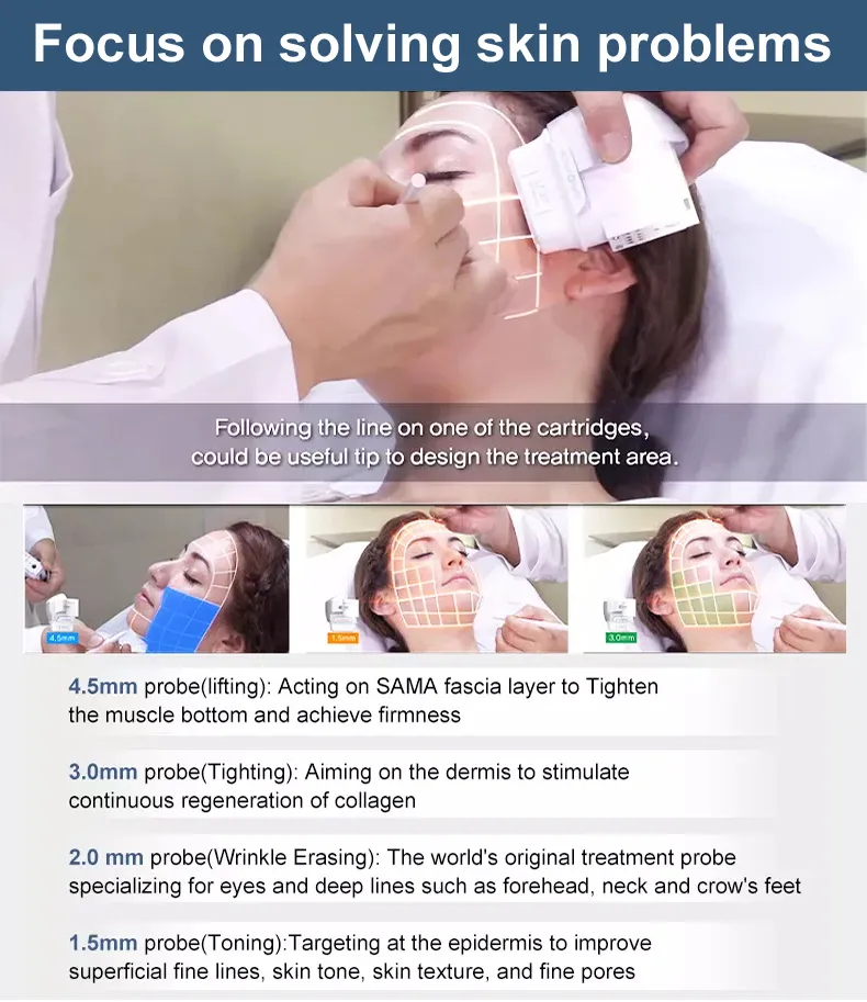 Hifu Machine Detail 5