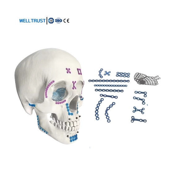 High Quality Medical Orthopedic Surgical Implants Titanium Maxillofacial Plate 1.5 2.0mm Plates