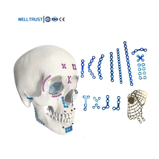 High Quality Medical Orthopedic Surgical Implants Titanium Maxillofacial Plate 1.5 2.0mm Plates