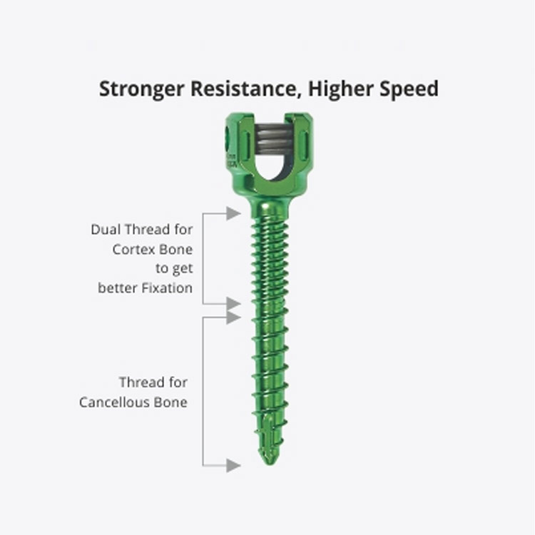 Veterinary Orthopedic Pedicle Screw System 2