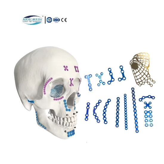 Maxillofacial Plate