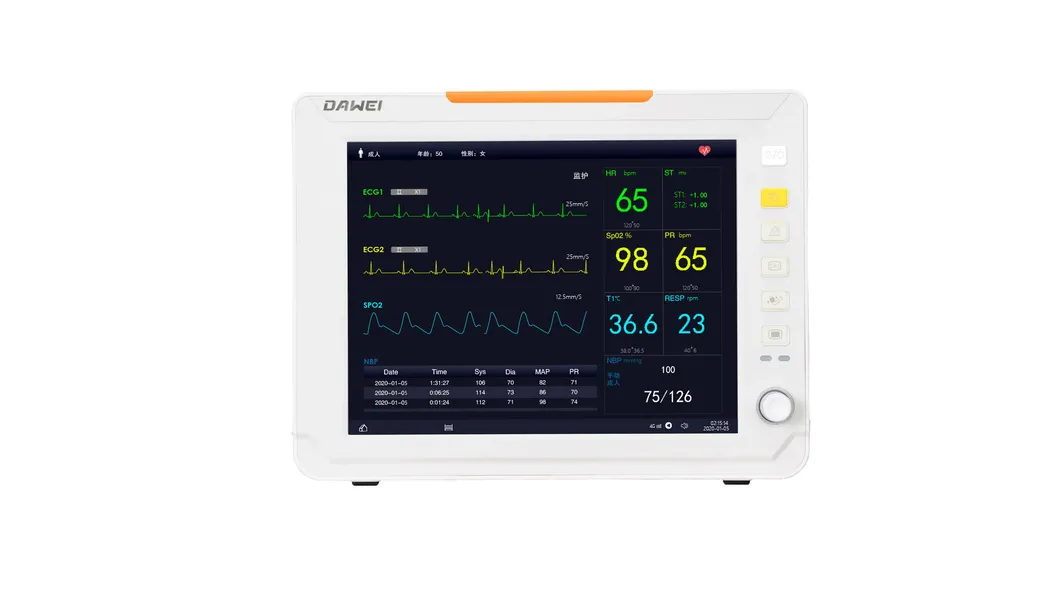 Portable ECG Monitor