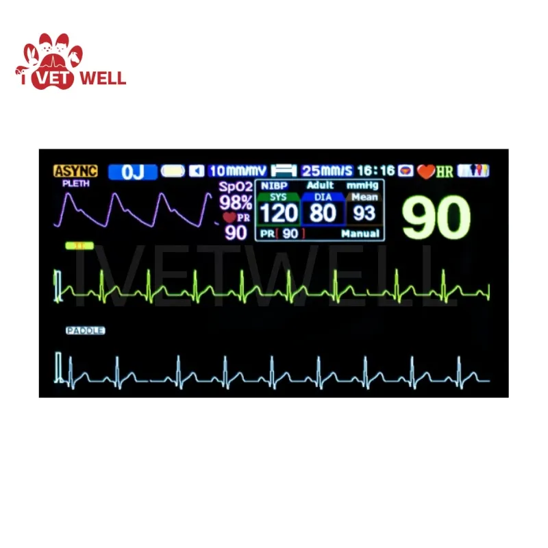 Defibrillator Screen Display