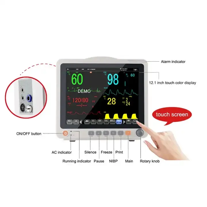 ICU Patient Monitoring System