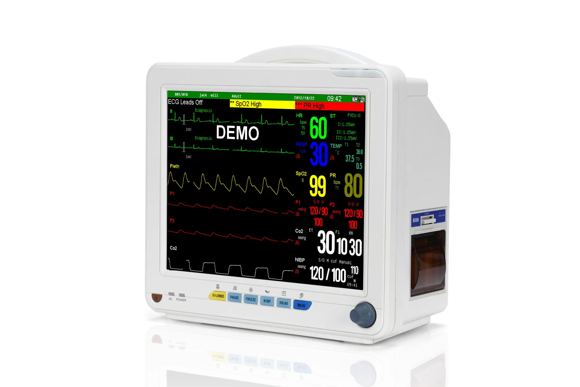 12 Inch Multi-Parameter Veterinary Monitor Vital Signs Monitor for Pets Clinics and Vet Hosptials HEV-9000N