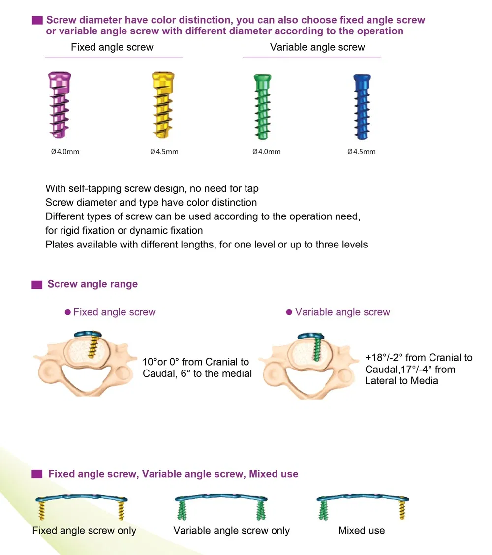 Anterior Cervical Plate System View