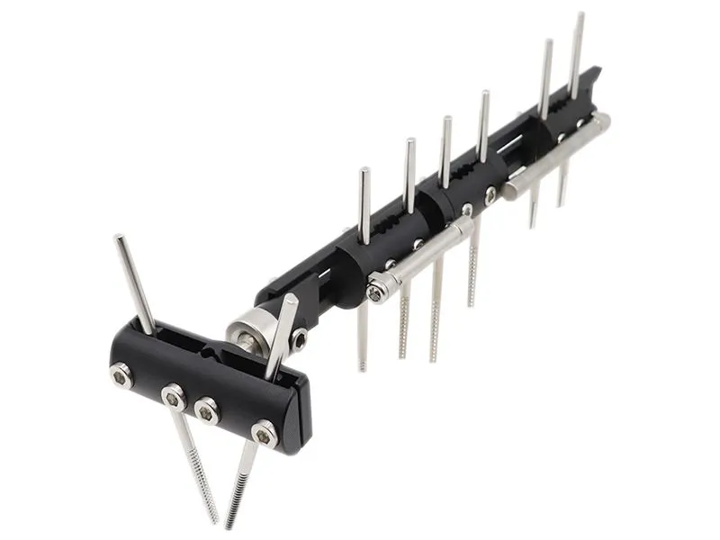 External Fixation Bone Lengthening 2