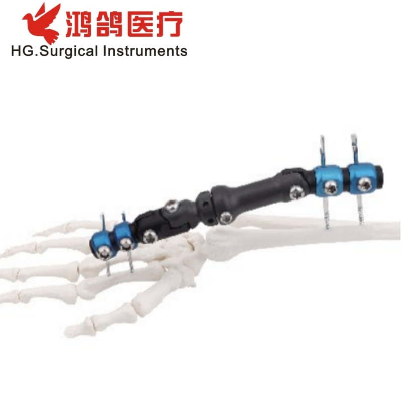 Orthopedic Wrist External Fixator Multiple Type Hospital Equipment Medical Supply Orthopedic Products