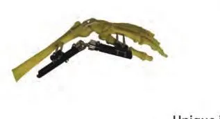 Orthopedic External Fixator View 2