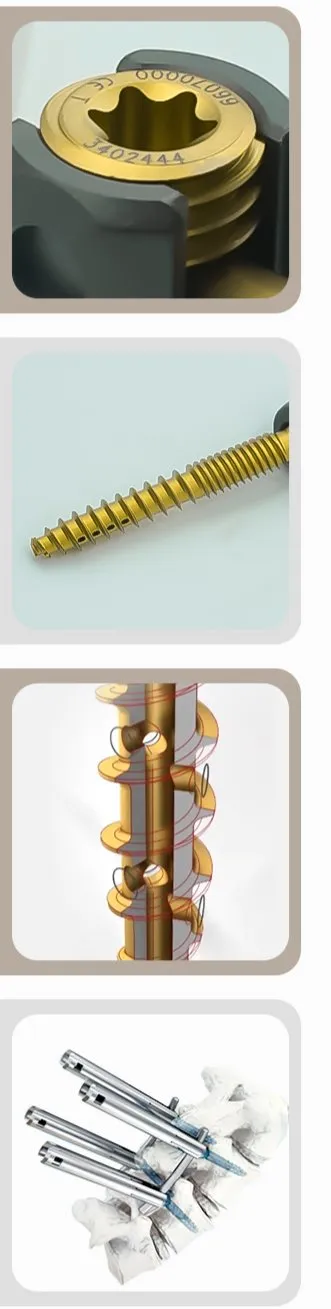 Advantage Illustration