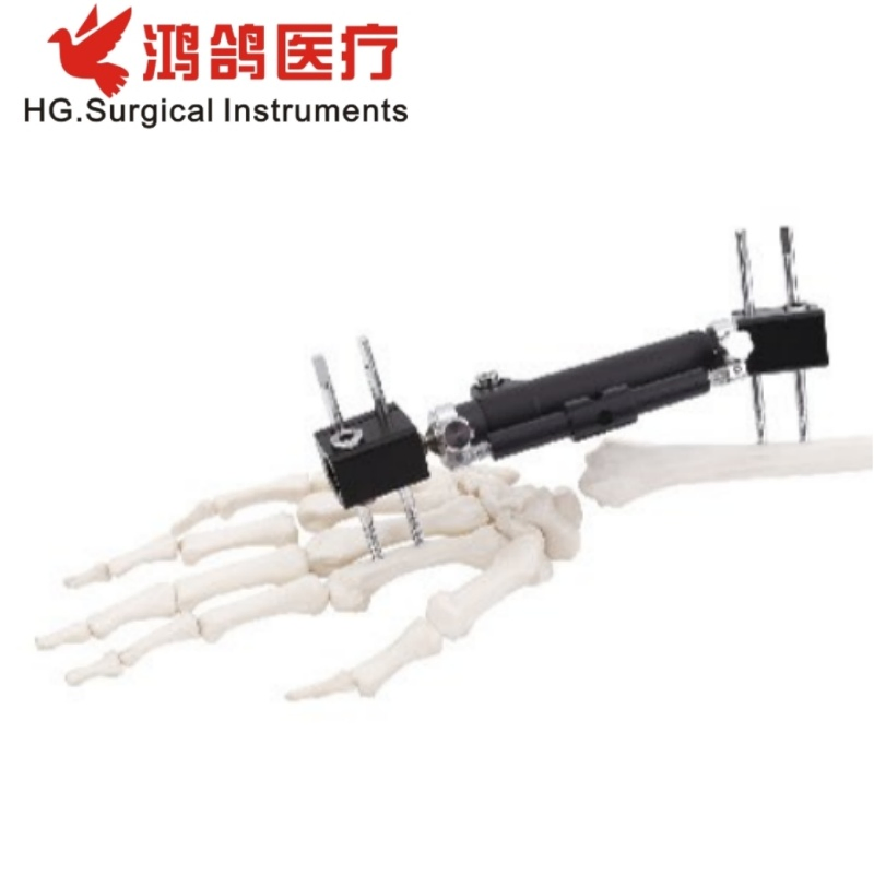 Orthopedic Wrist External Fixator Multiple Type Hospital Equipment Medical Supply Orthopedic Products