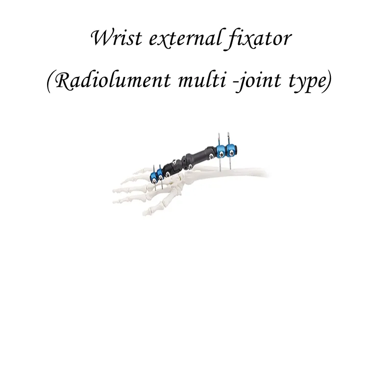 Orthopedic Wrist External Fixator