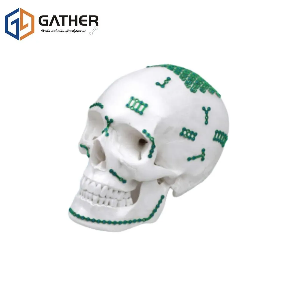 Maxillofacial Implant View