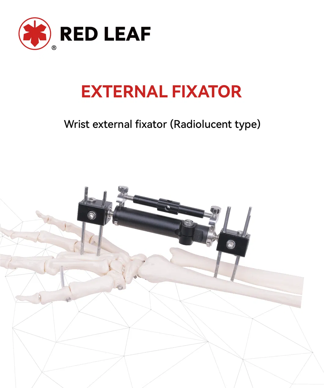 Premium Radiolucent Orthopedic External Fixator