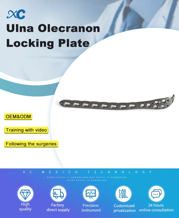 Ulna Olecranon Locking Plate