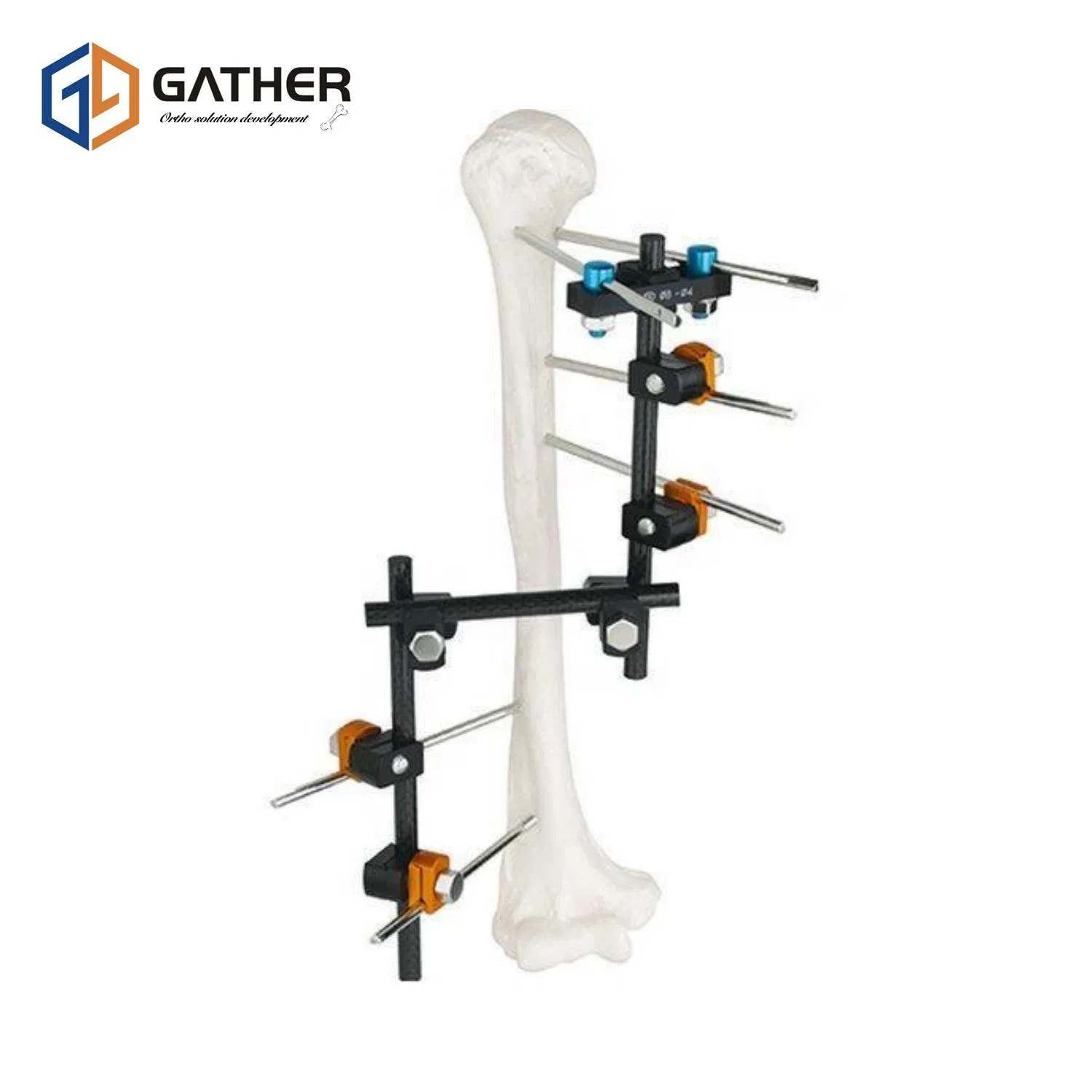 External Fixator Sterilized Package Gather Biotech Carbon Fiber Factory Price Orthofix with Low