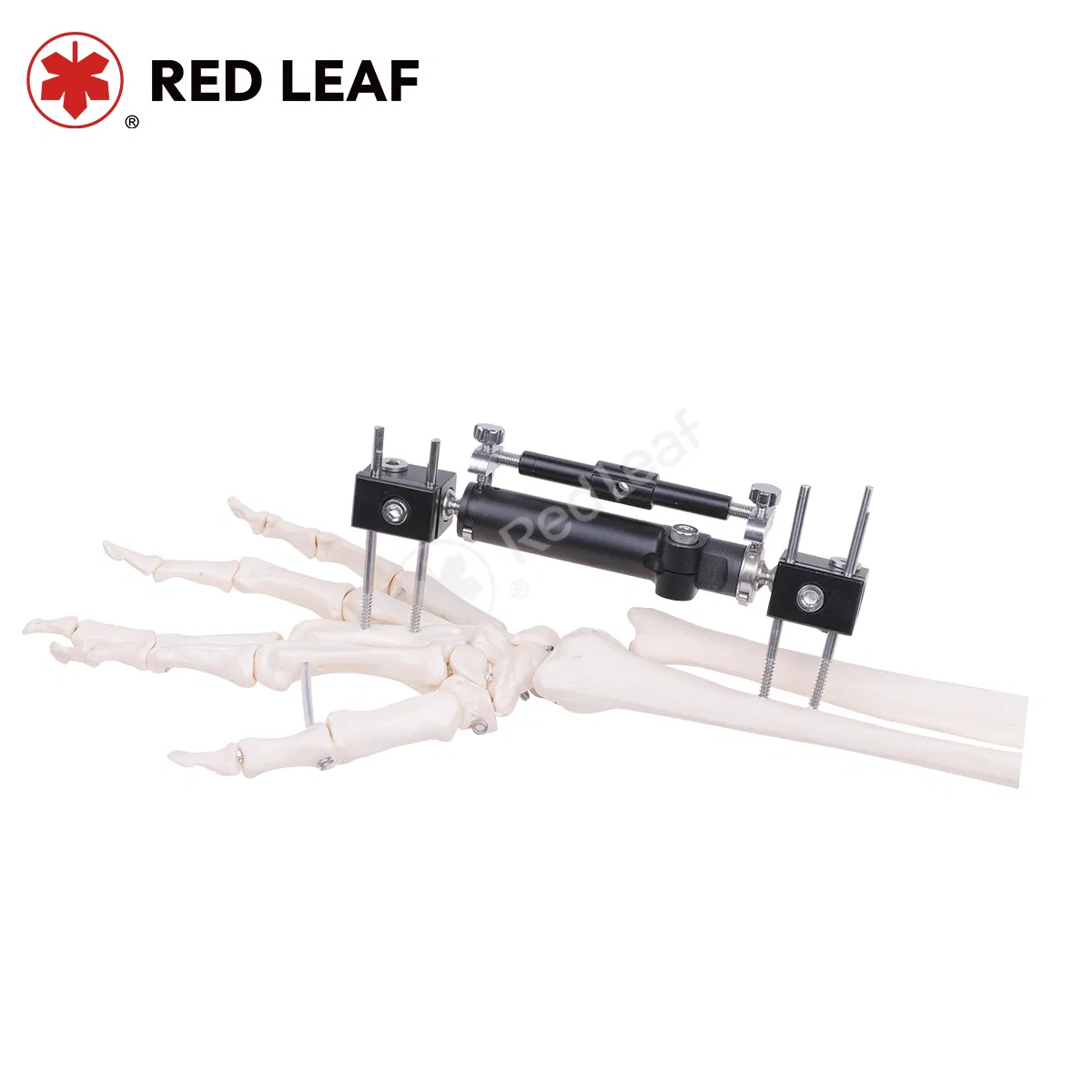 Premium Radiolucent Orthopedic External Fixator Surgical Instrument for Wrist Stabilization