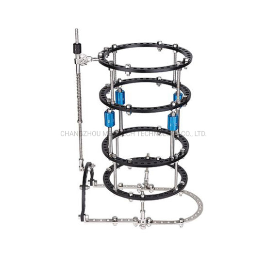 Orthopedic Instruments Ilizarov Ring Bone Lengthening External Fixator Talipes Equinovarus