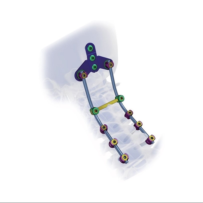 Pedicle Screw Fixation System Orthopaedic Spinal Implants Posterior Cervical Surgery Orthopedic Spine Surgical Instruments Set