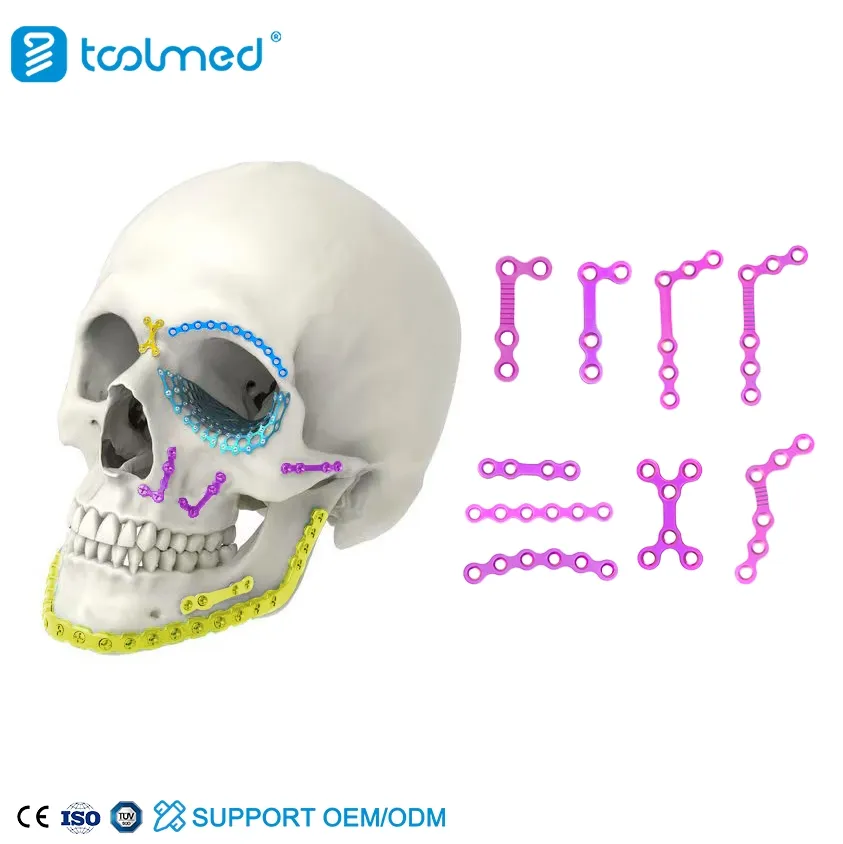 Maxillofacial Plates 3