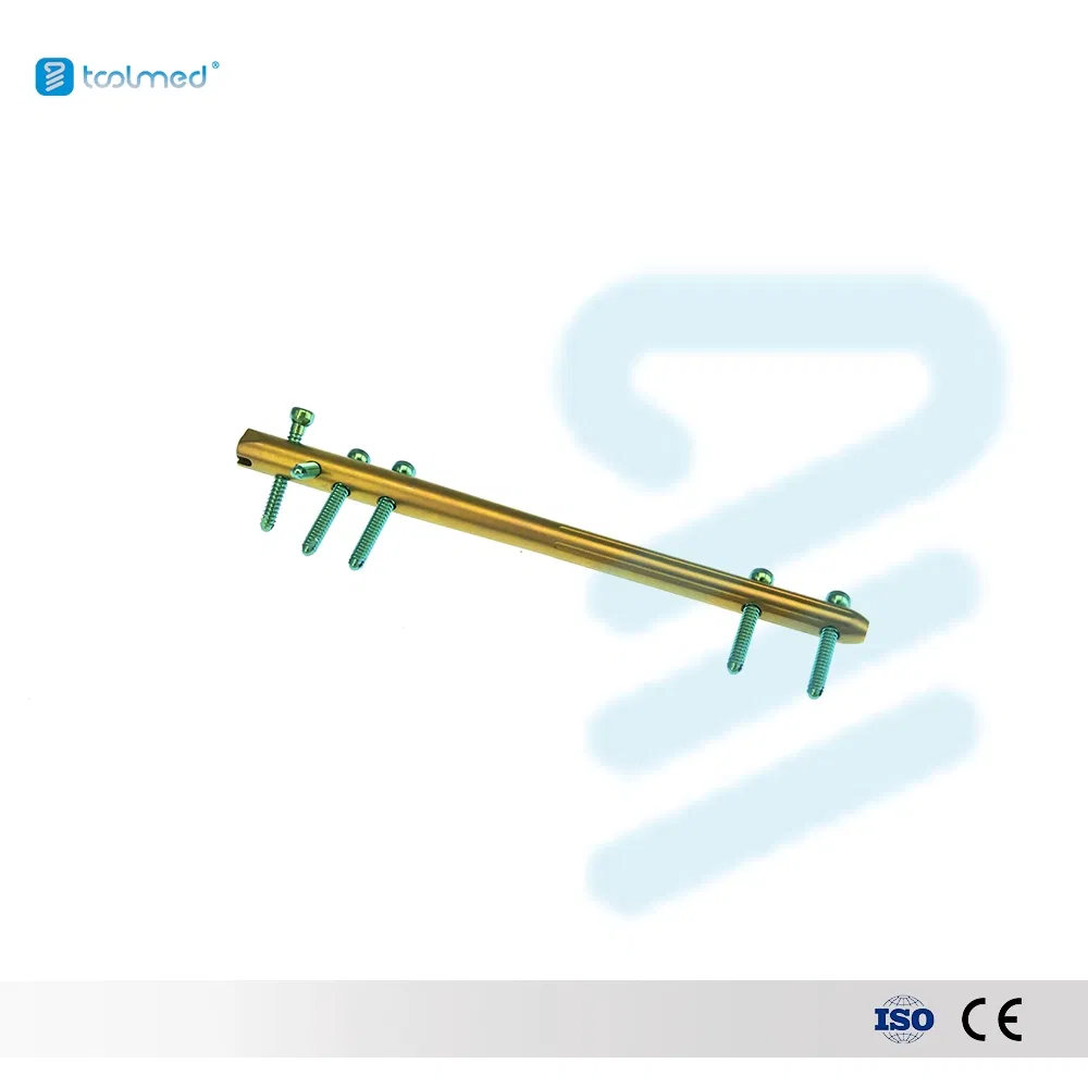 Orthopedic Fixation with Retrograde Intramedullary Femur Interlocking Intramedullary Nails 11*200