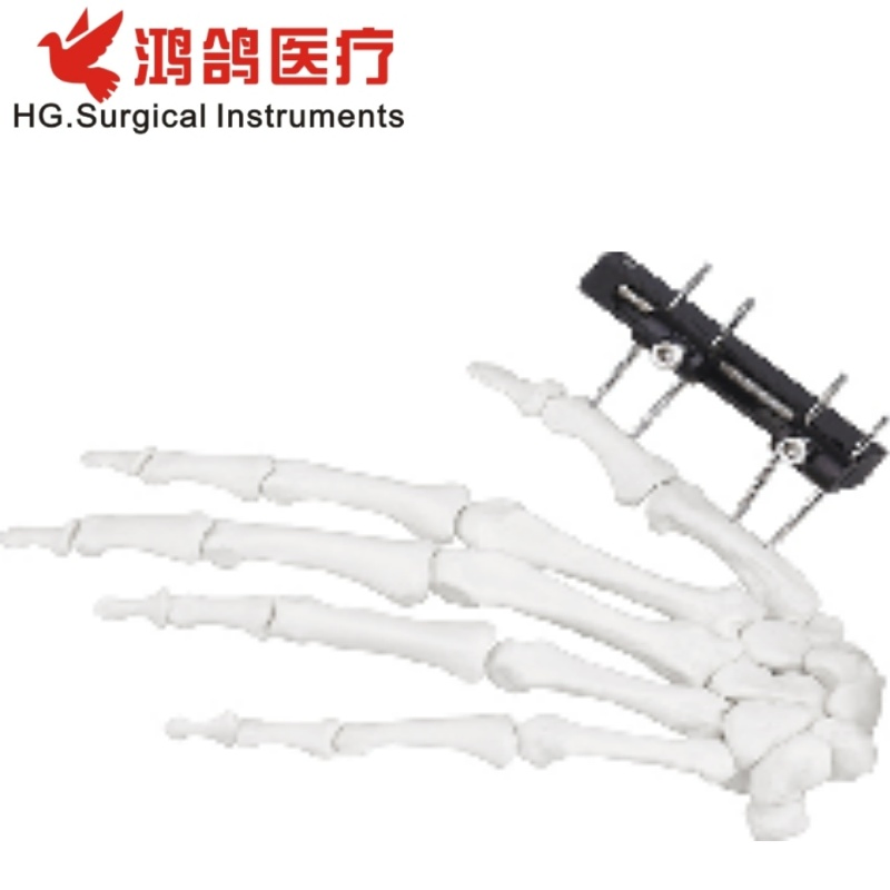 Orthopedic Mini Fixator Joint Motion Type Orthopedic External Orthopedic Products Orthopedic Instrument