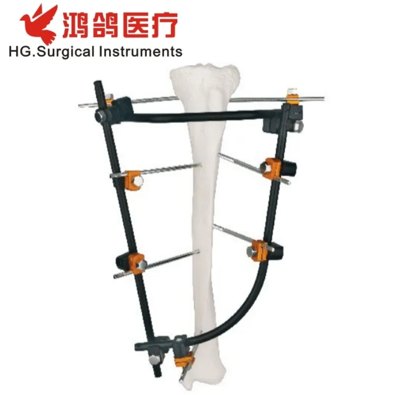 Orthopedic External Fixator 3