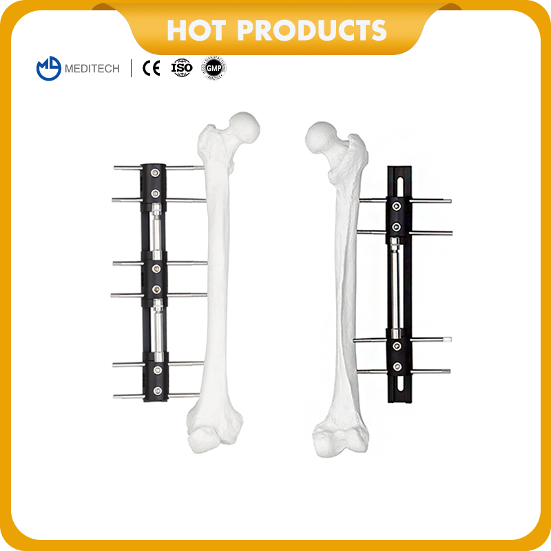 CE Professional Orthopedic External Fixation Bone Lengthening External Fixators for Fracture Surgery