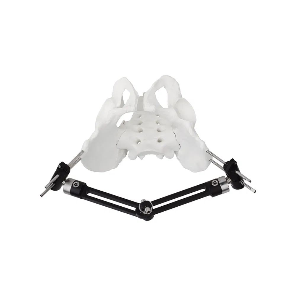 Orthopedic Surgery Pelvic External Fixator Two Section Type External Fixator