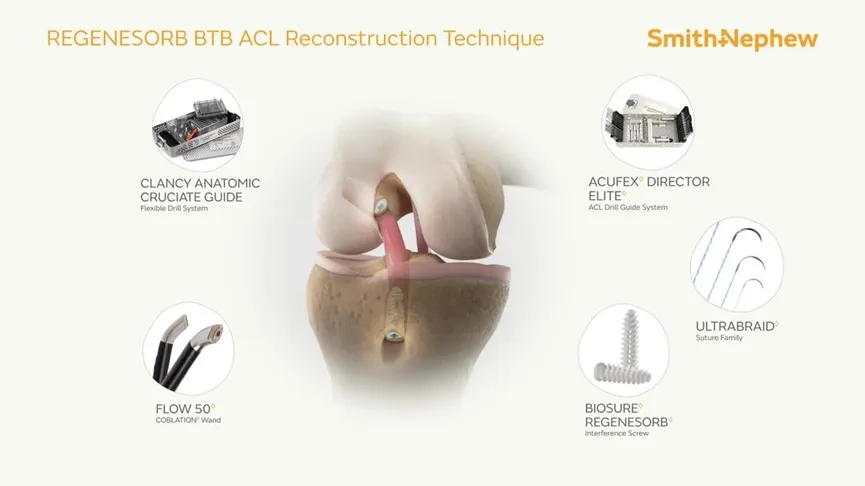 Interface Screws Product View