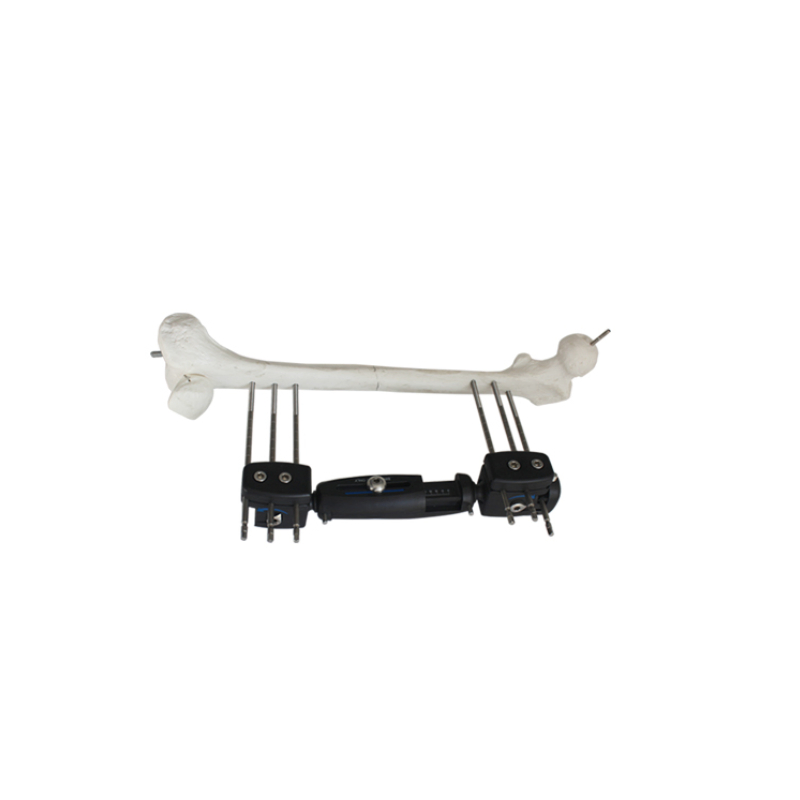 Medical Orthopedic Peek Carbon Fiber Rod Pin Clamp External Fixator for Orthopedic External Fixation Surgery