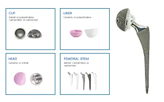 Hip Joint Implants 3
