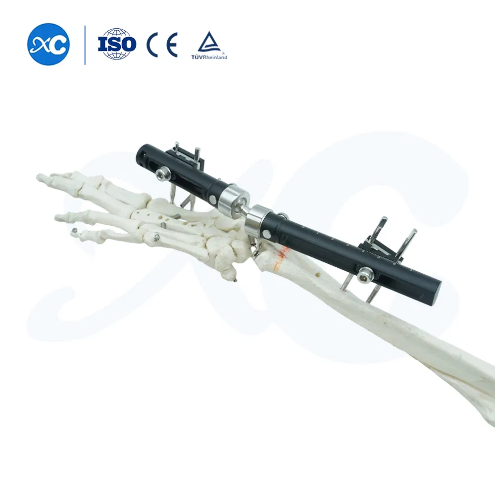 Factory Direct Supply Orthopaedic External Fixation Device, Ulna &amp; Radius External Fixator OEM ODM