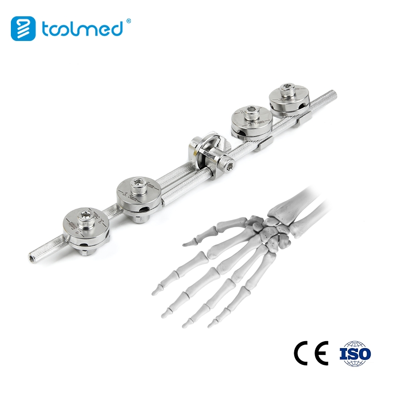 External Fixator Medical Implants External Fixation Orthopedic Custom Wrist Joint Fixator