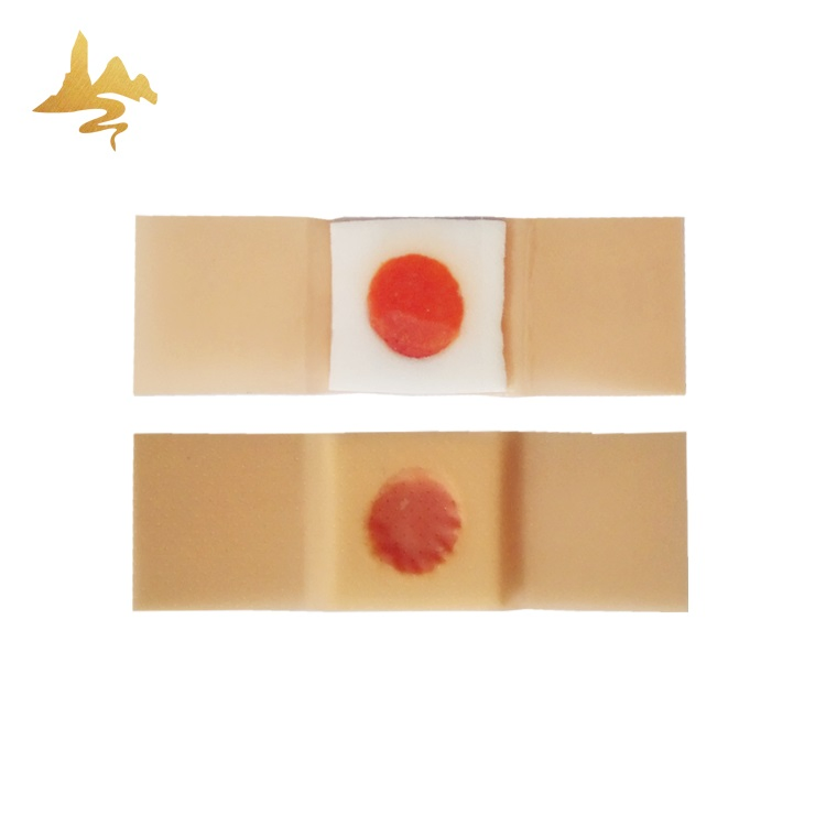 China Factory Price Foot Care Pain Relief Patch Salicyl Acid Corn Wart Removal Plaster